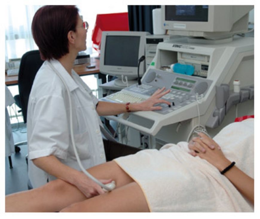 Ces varices nécessitent un traitement